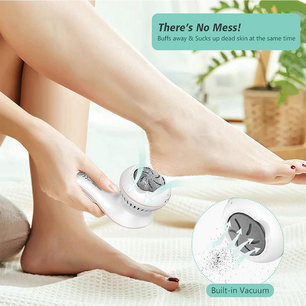 Igia Callus Remover - Retail Therapy Online