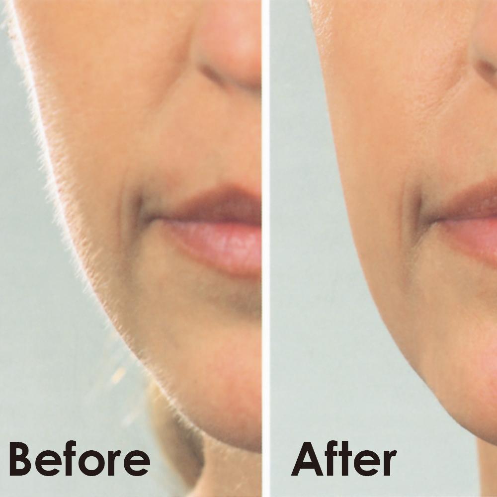Igia Dermaplaner Hair Remover - Retail Therapy Online