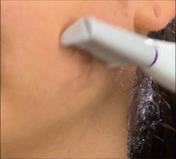 Igia Dermaplaner Hair Remover - Retail Therapy Online